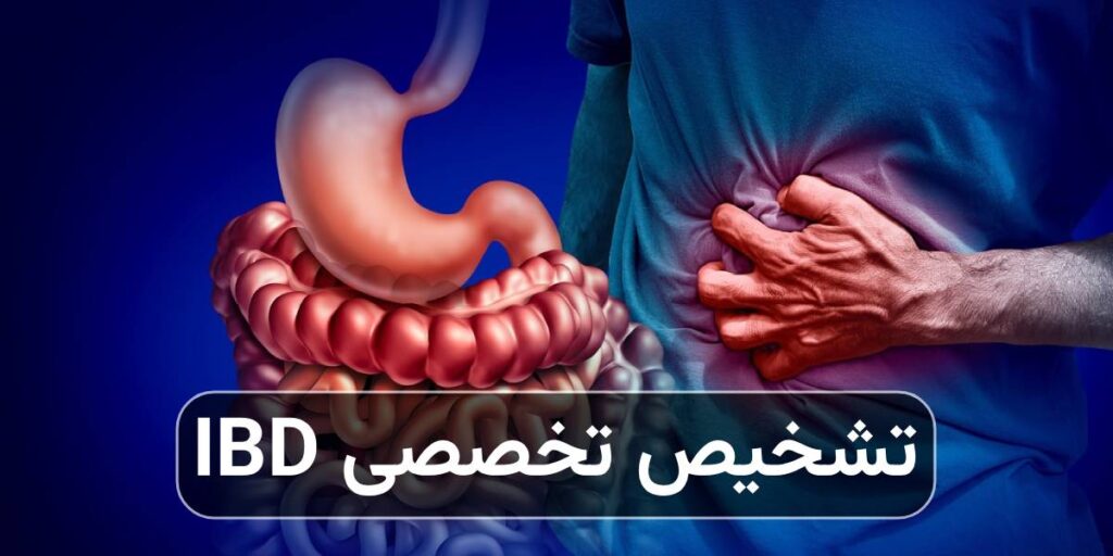 تشخیص تخصصی IBD