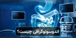 اندوسونوگرافی چیست