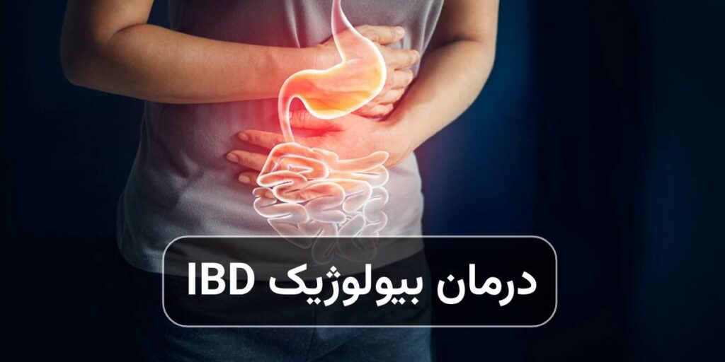 درمان بیولوژیک IBD چیست