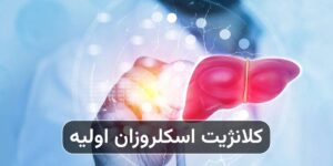 کلانژیت اسکلروزان اولیه