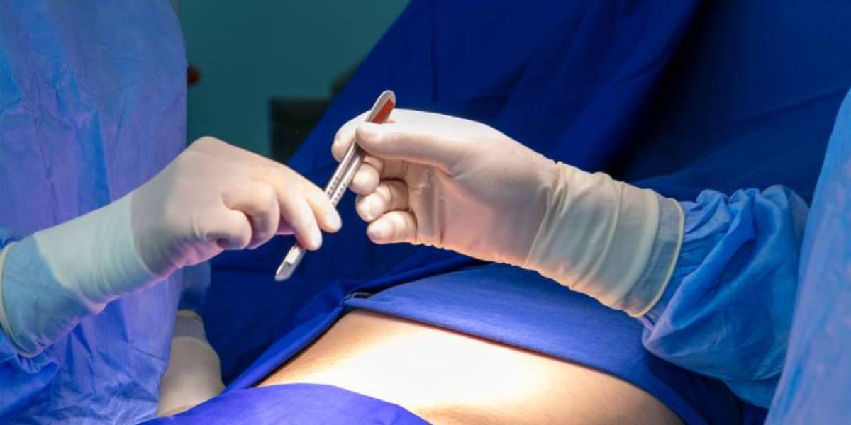 جراحی تخصصی کرون و کولیت اولسروز