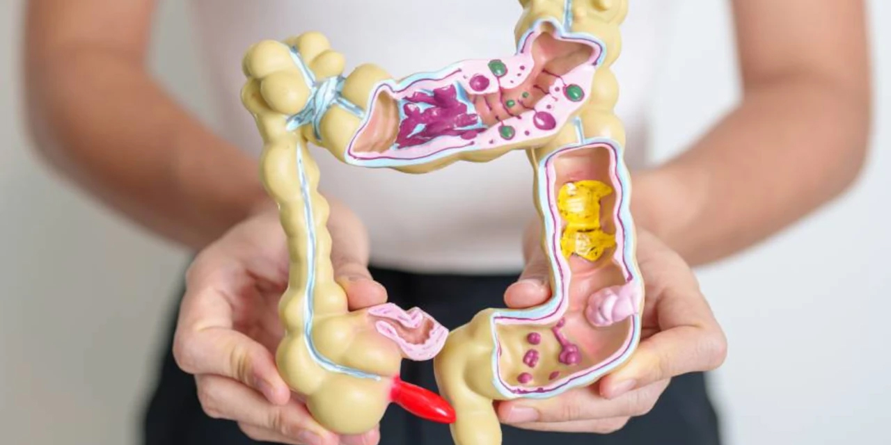 درمان کولیت اولسروز