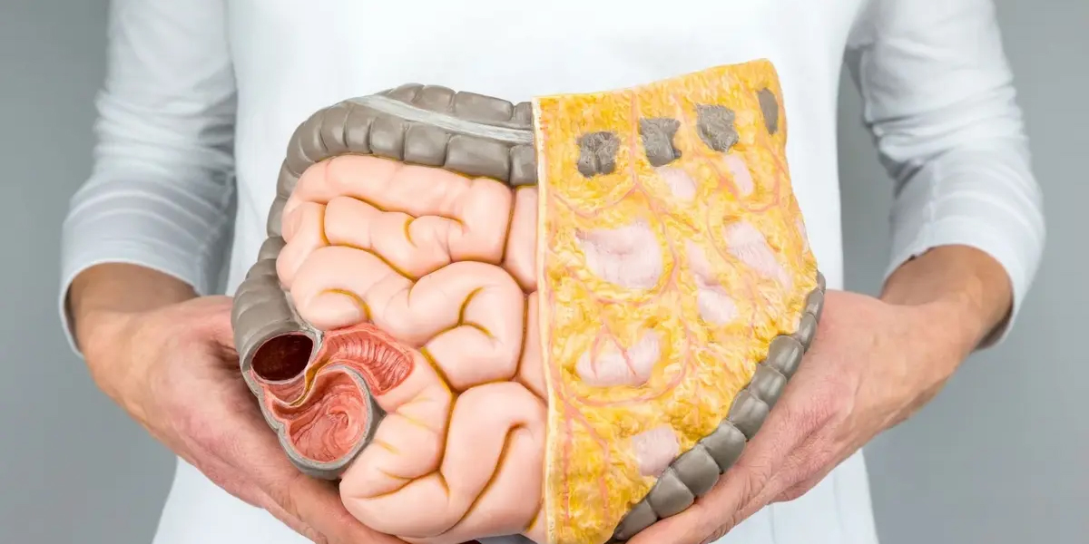 علائم کولیت روده