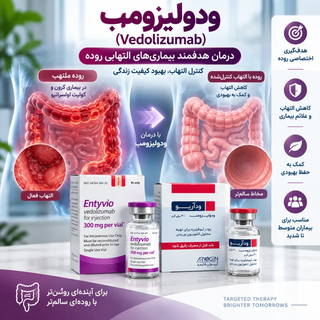 ودولیزومب 